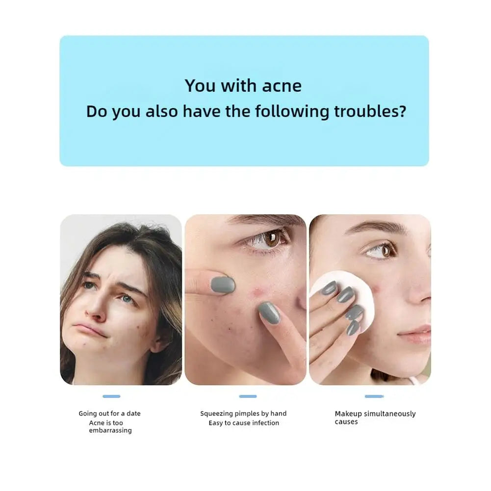 32patch Acne Pimple Patches Hydrocolloid Invisible Healing Absorbing Spot Sticker For Inflamed Acne Improve Whiteheads Skin Care