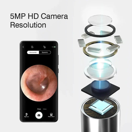 Wireless Visual Ear Endoscope Camera Ear Cleaning Tools Spoon Safe Silicone Earpick 5MP Camera Ear Wax Remover Luminous Otoscope Good Vibrations