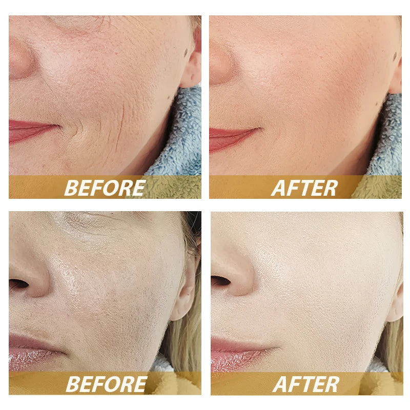 Wrinkle Removal Retinol Serum Facial Serum Rejuvenation Lift Firming Anti-aging Whitening Invisible Pores Beauty Skin Care Good Vibrations