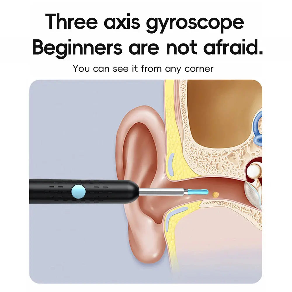 Wireless Visual Ear Wax Removal Safe Endoscope Earpick with Camera 500W Pixel Luminous Otoscope Ear Cleaning Tools Good Vibrations