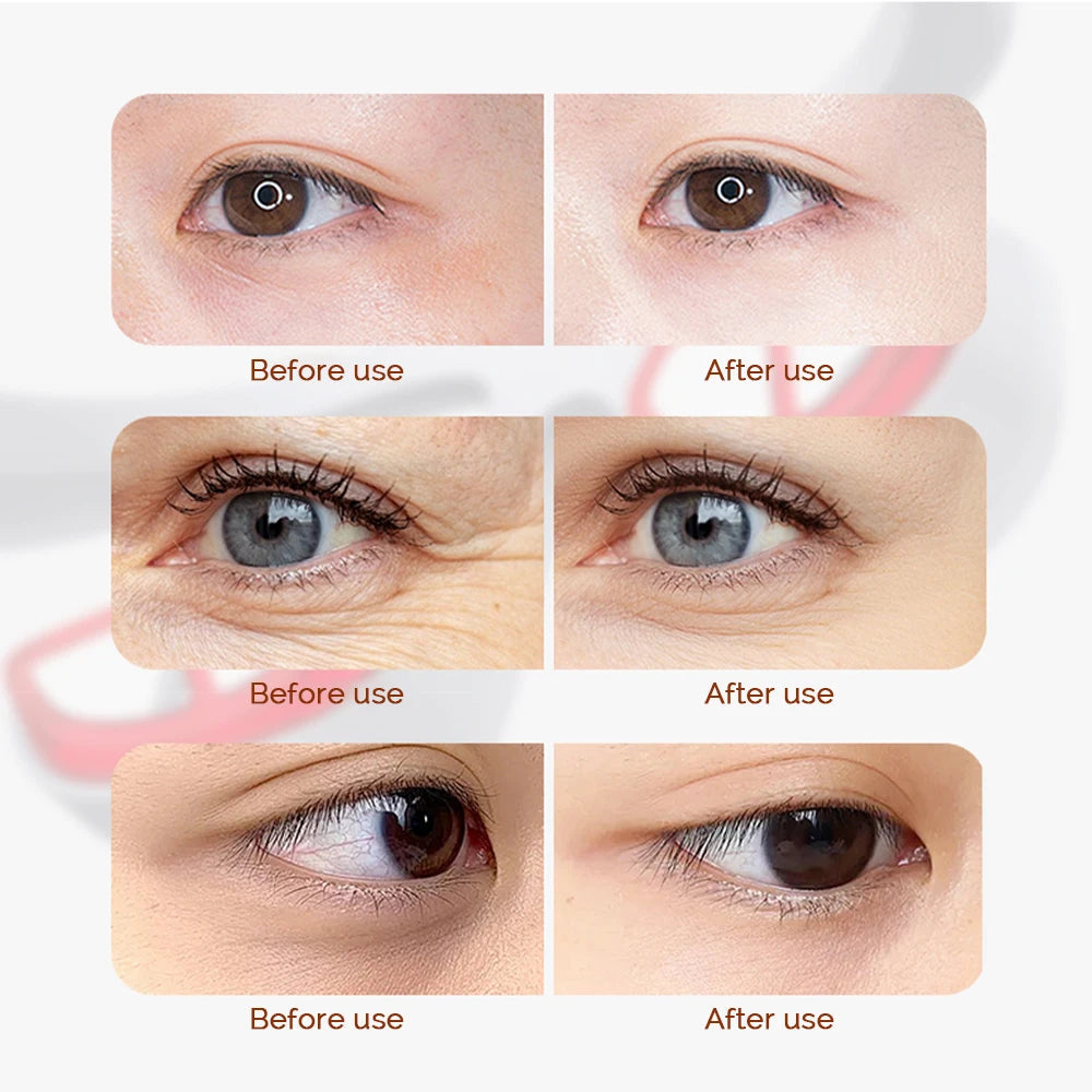 Electric Eye Massager Red Light Relieves Eye Fatigue Eyes Massage Glasses Hot Compress Eye Glasses Massager Dark Circles Remover Good Vibrations