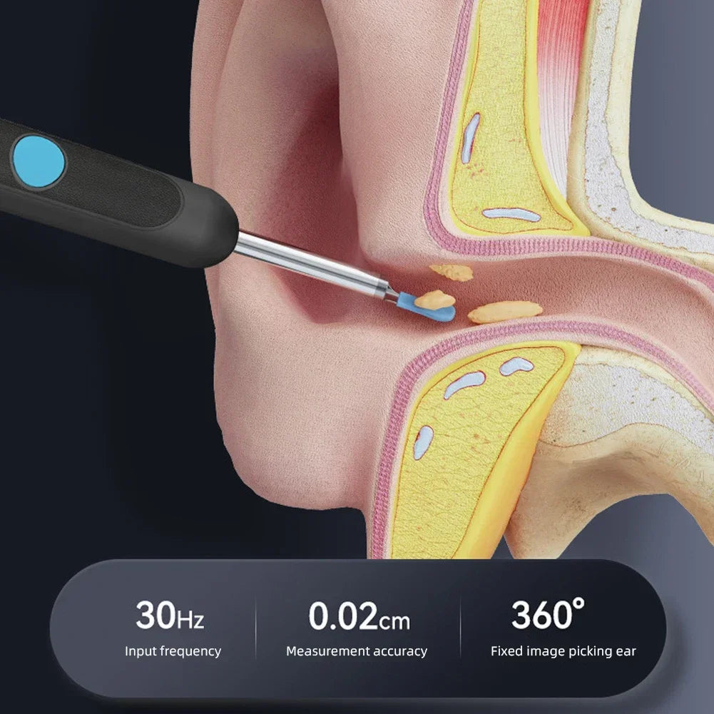 Smart Visual Ear Sticks Otoscope Endoscope Wax Removal Tool Earpick Mini Camera Health Care Ear Cleaner Good Vibrations