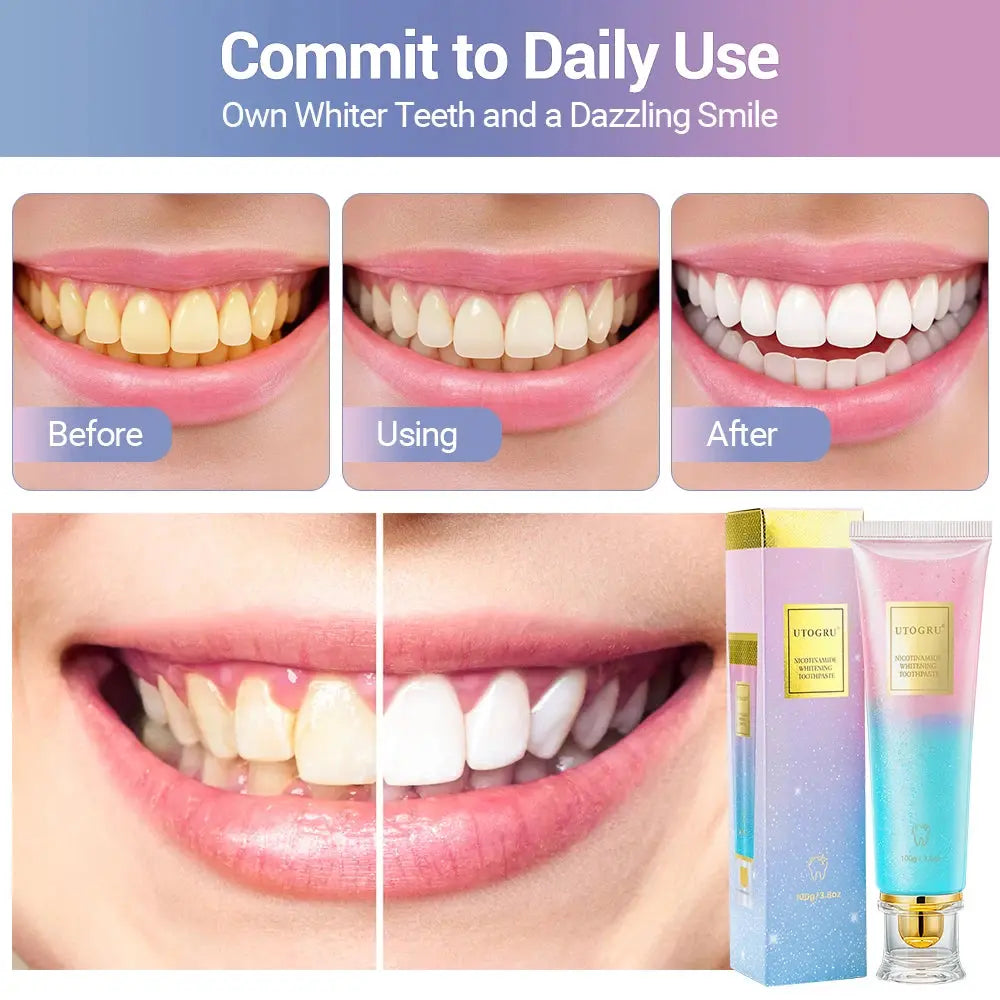 Whitening Toothpaste Nicotinamide Dazzling Toothpaste Remove Plaque Stains Teeth Oral Hygiene Clean Fresh Breath Teeth Care 100g Good Vibrations