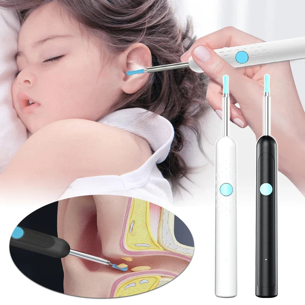 Smart Visual Ear Sticks Otoscope Endoscope Wax Removal Tool Earpick Mini Camera Health Care Ear Cleaner Good Vibrations