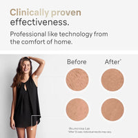 IPL Hair Removal Device 999999 Flashes  Permanent Epilator Body Treament Home Use for Women Men Facial Shaver Cutting Machine Good Vibrations