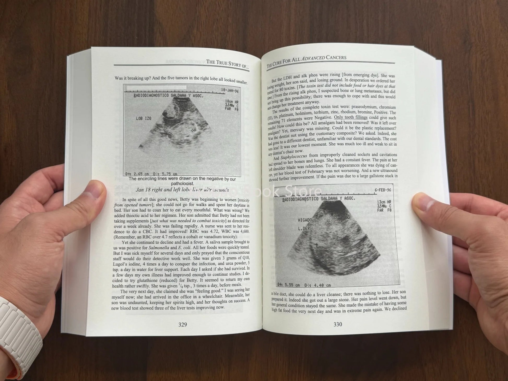 The Cure for All Advanced Cancers Book By Dr. Hulda Clark | Tumor Treatment Natural Therapy Guide Good Vibrations