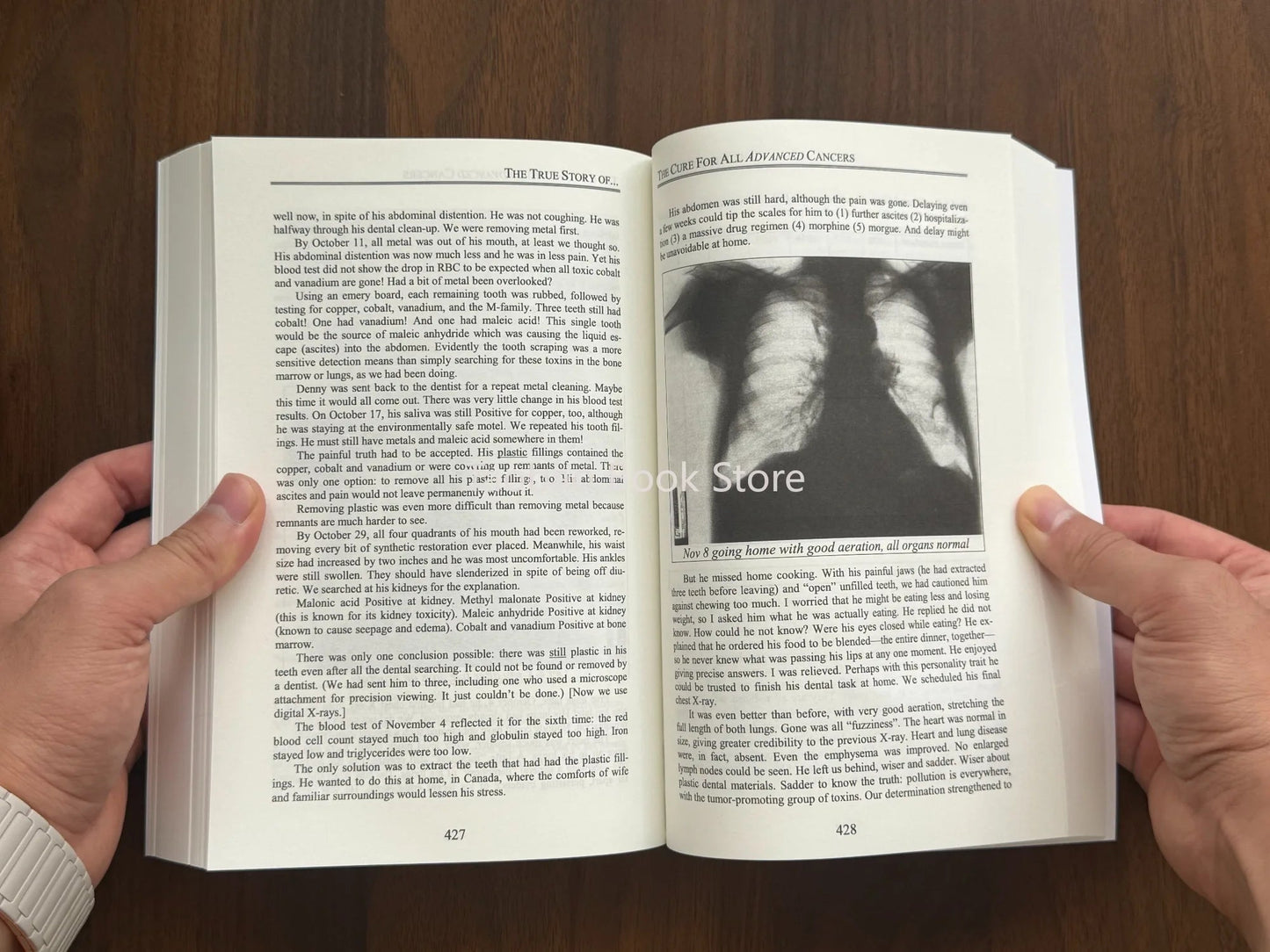 The Cure for All Advanced Cancers Book By Dr. Hulda Clark | Tumor Treatment Natural Therapy Guide Good Vibrations